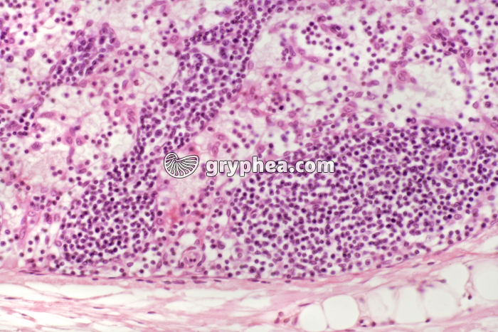 Ganglion lymphatique x100 - gryphea.com